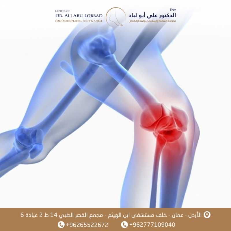 افضل علاج لخشونة الركبة