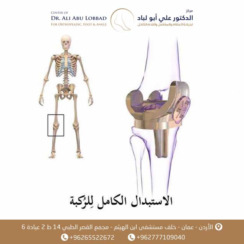 جراحة الركبة والاستبدال الكامل لمفصل الركبة