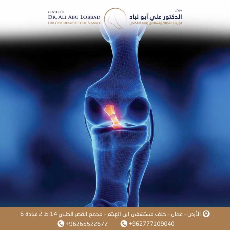 إصابة الرباط الجانبي الأنسي (MCL)