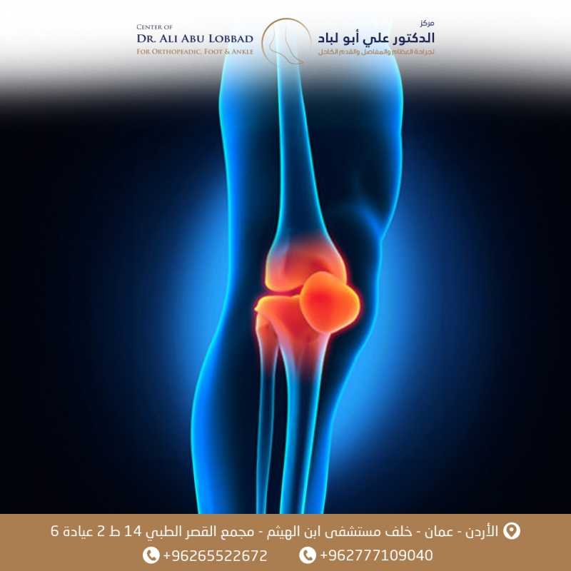 الخلع المتكرر لعظمة الصابونة