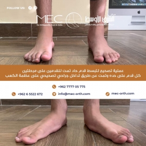 عملية تصحيح لتبسط القدم