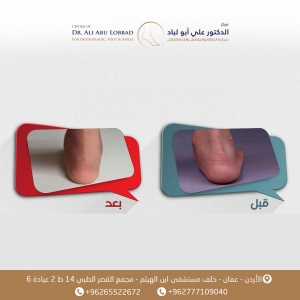 مركز الدكتور علي ابو لباد